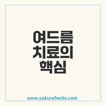 아이소주브: 여드름 치료의 효능과 레씨범 교체 여부